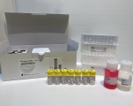 白蛋白放射免疫分析試劑